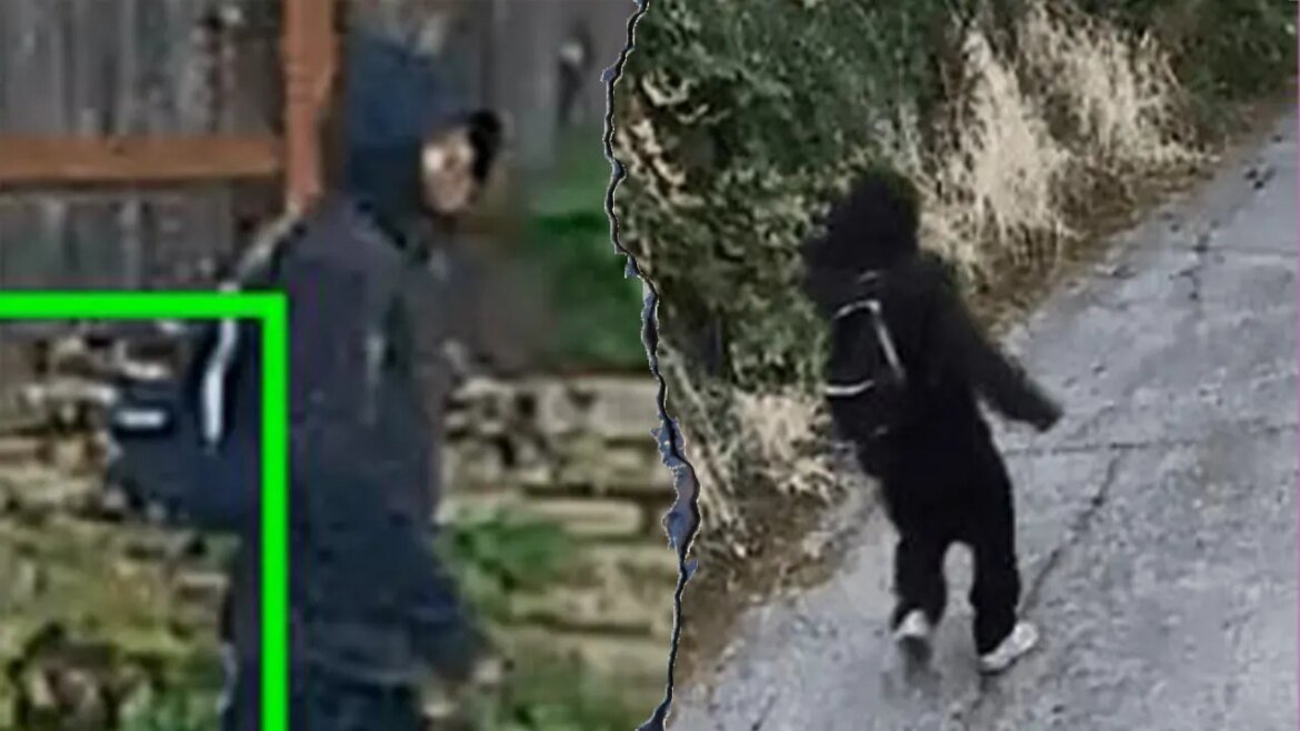 88-year-old woman hospitalized after finger bitten off in robbery: police