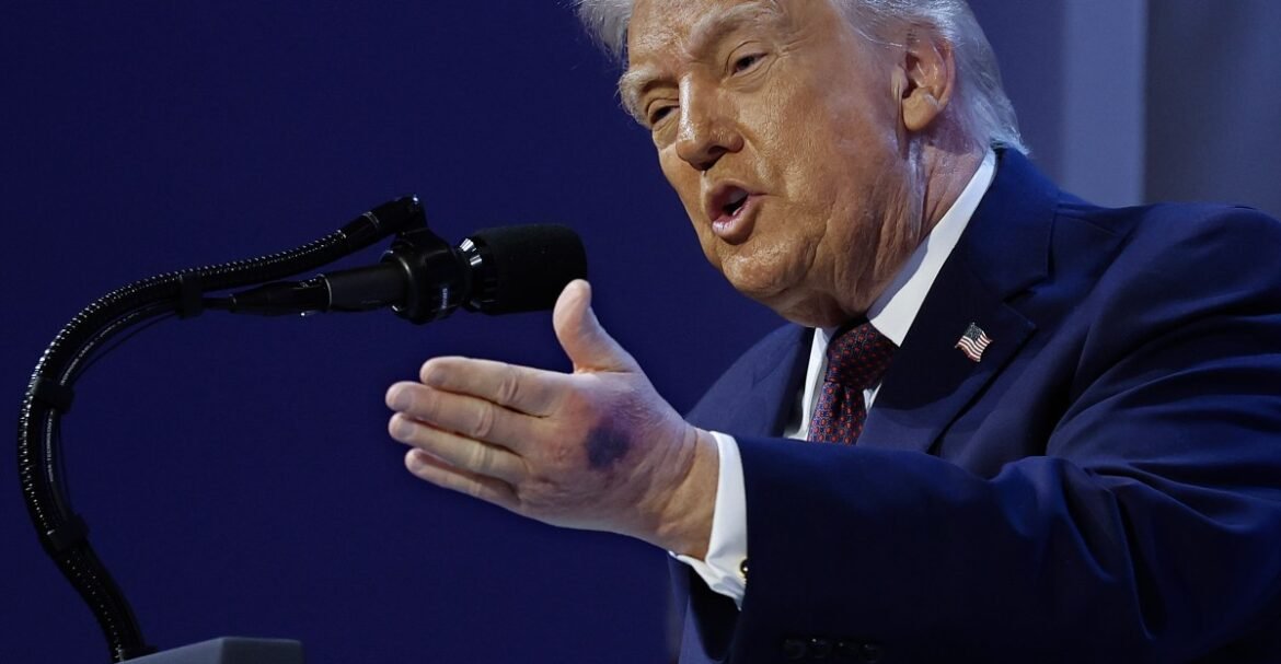 Donald Trump health: At the president’s age, is he OK?