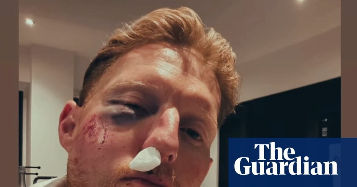 ‘You should see the cricket ball’ jokes Ben Stokes after being struck in the face | Ben Stokes