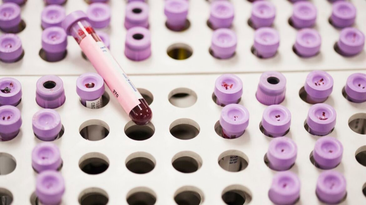 New guidelines offer updated approach for managing high cholesterol : NPR