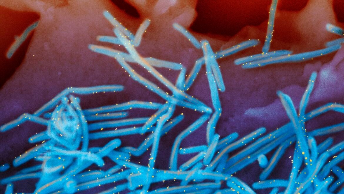 RSV shots for babies under FDA review despite evidence of safety : NPR