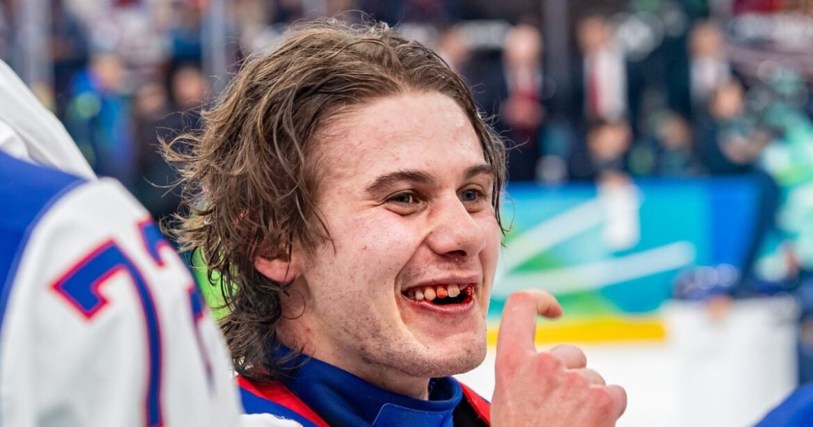 U.S. Olympic hockey hero Jack Hughes finally fixes teeth broken in gold medal game