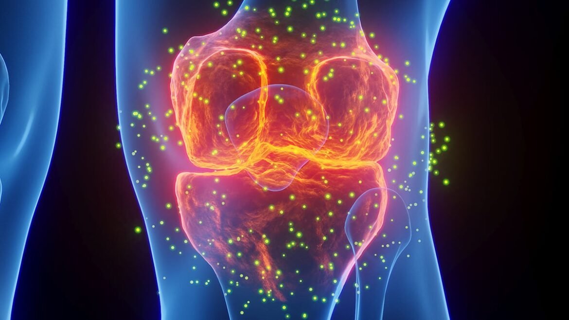 Common Gout Medications Linked to Lower Risk of Heart Attack And Stroke : ScienceAlert