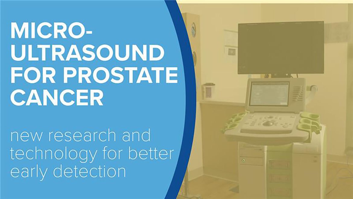 How Micro‑Ultrasound Can Improve Prostate Biopsy | News