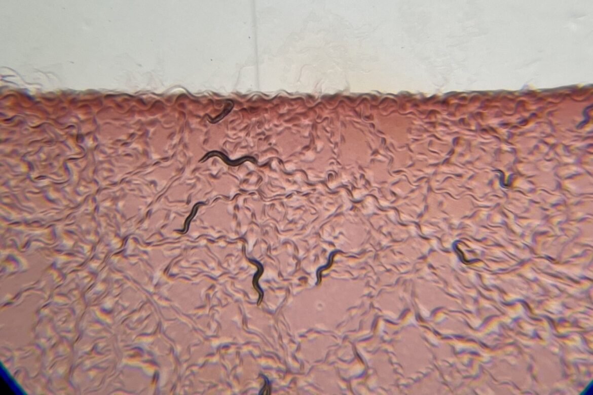 How neurons sense bacteria in the gut | MIT News