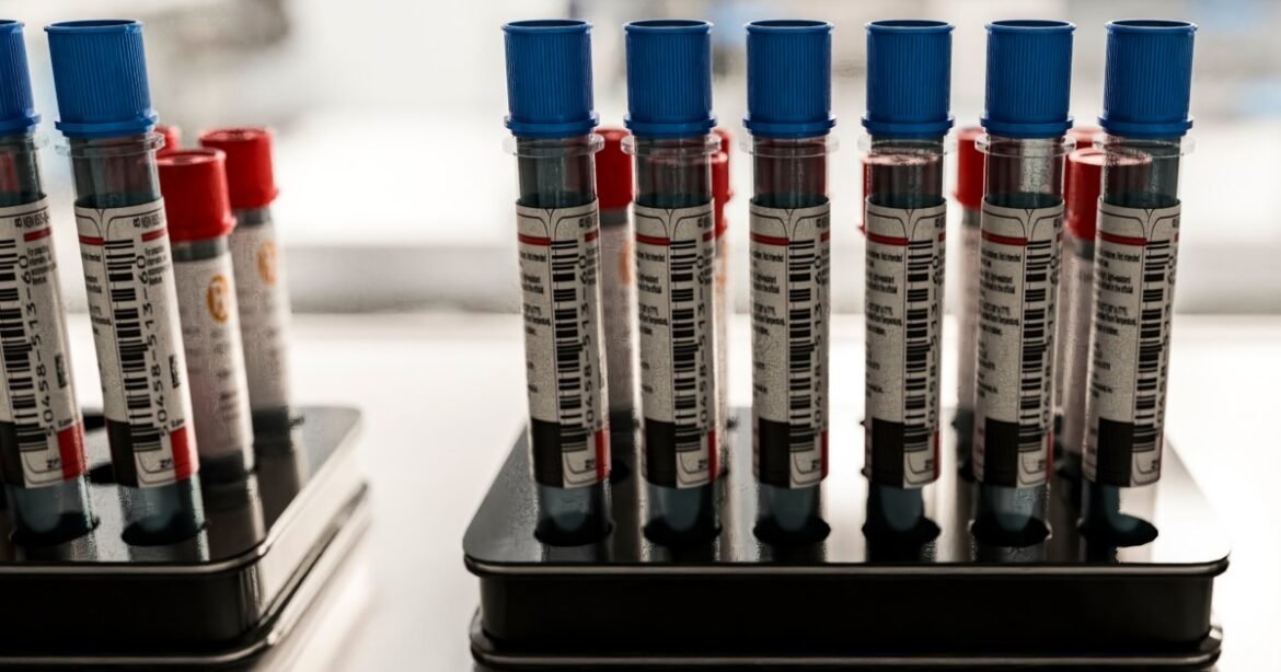 Patients say they want Alzheimer's blood tests. Doctors aren't sure they help.