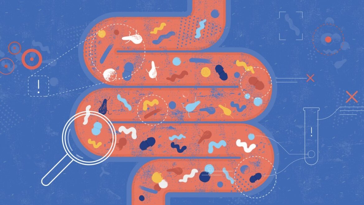 What is behind the rise in younger colorectal cancers? : NPR
