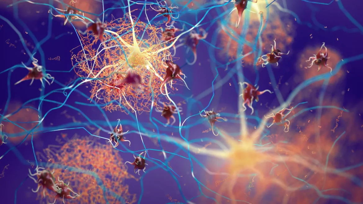 Boosting one protein helps the brain fight Alzheimer’s