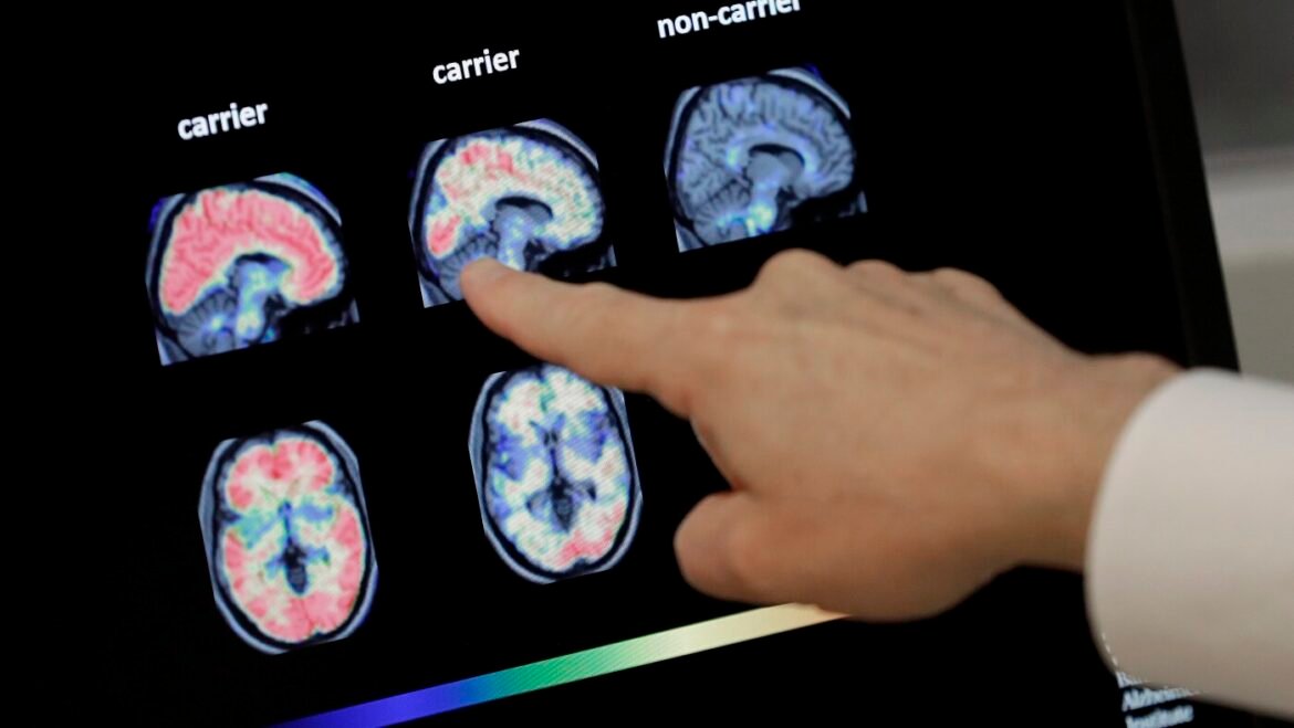 Can Chinese AI solve inequality? + How dementia comes for your bank account : NPR