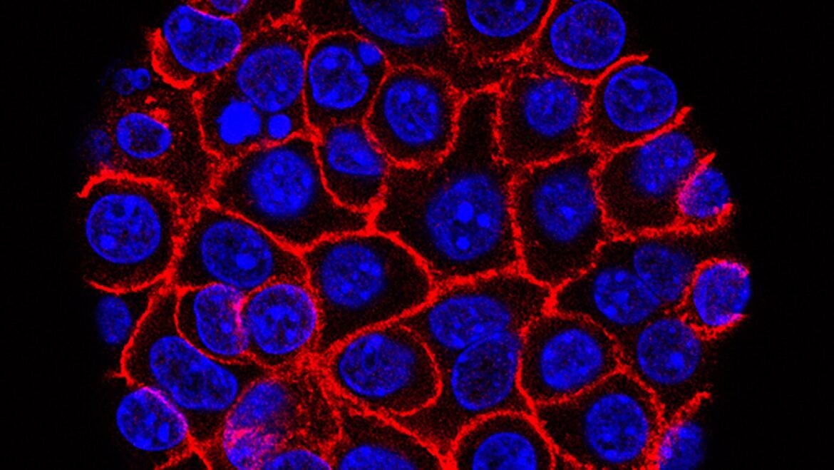 Experimental pill promises new hope for deadly pancreatic cancer : NPR