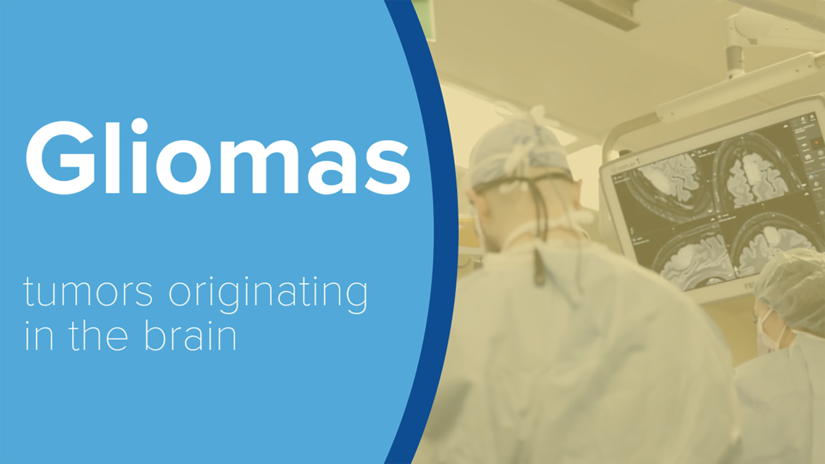 Gliomas and Glioblastoma: Treatment for Primary Brain Tumors | News