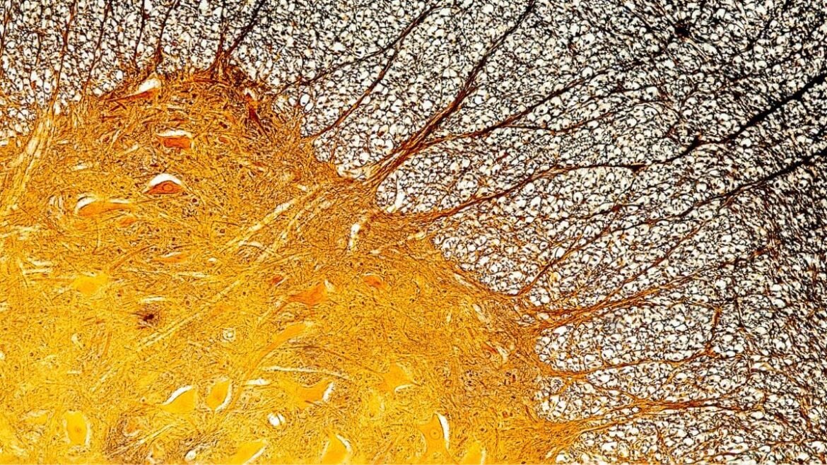 Immune Cell Discovery Might Explain Multiple Sclerosis at Its Worst : ScienceAlert
