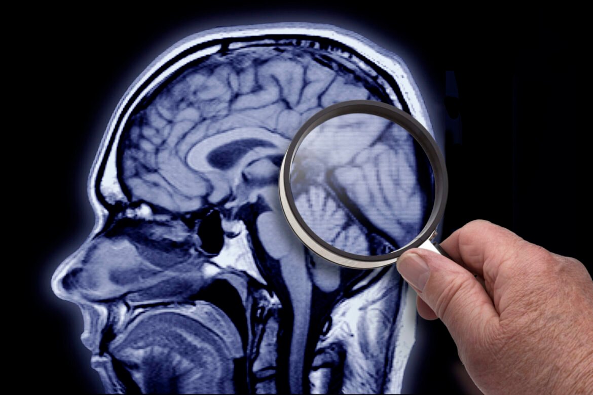 New Rutgers program aims to study the female brain • New Jersey Monitor
