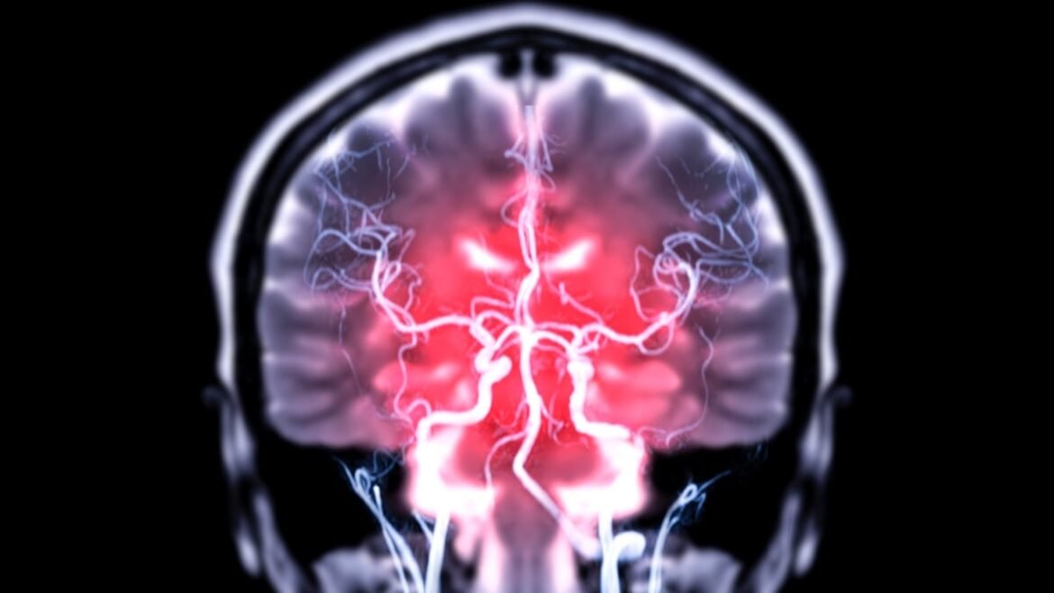 Common Hormonal Contraceptive Linked to Risk of Rare Brain Tumor : ScienceAlert