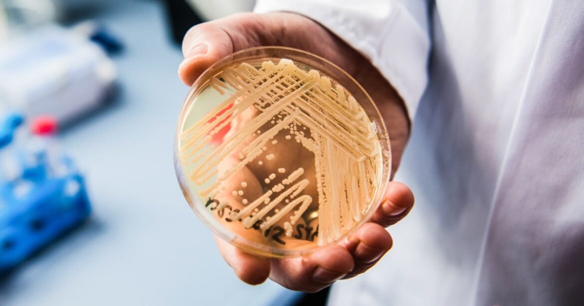 Drug-resistant fungus Candida auris still on the rise in the U.S.