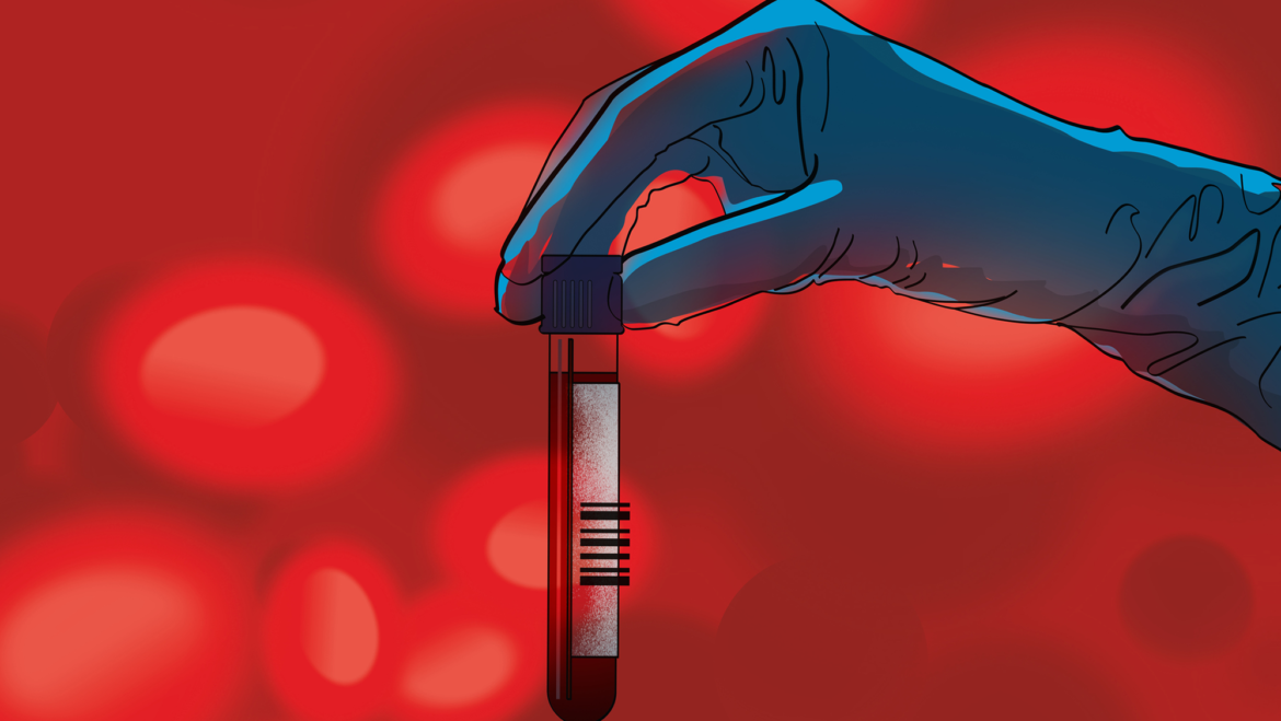 Earlier diagnosis but limited treatment options: What to know about blood tests for Alzheimer's disease