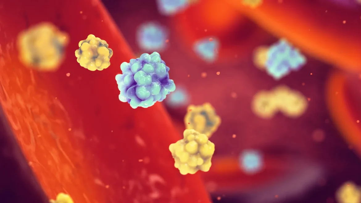 Misfolded insulin may be quietly driving diabetes