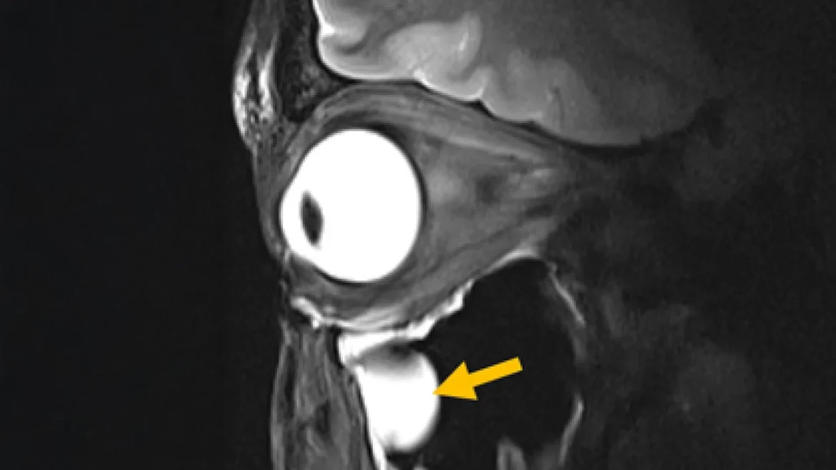 New MRI breakthrough reveals the brain and eye like never before