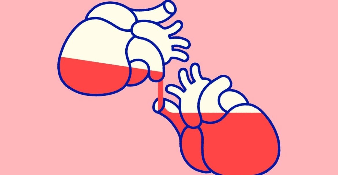 The breakthrough changing how Americans donate organs