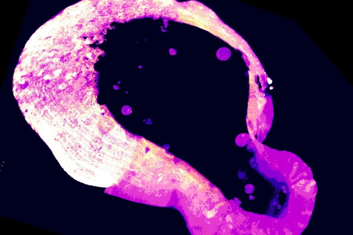 Cells use a little-known molecule to protect themselves from iron overload | MIT News