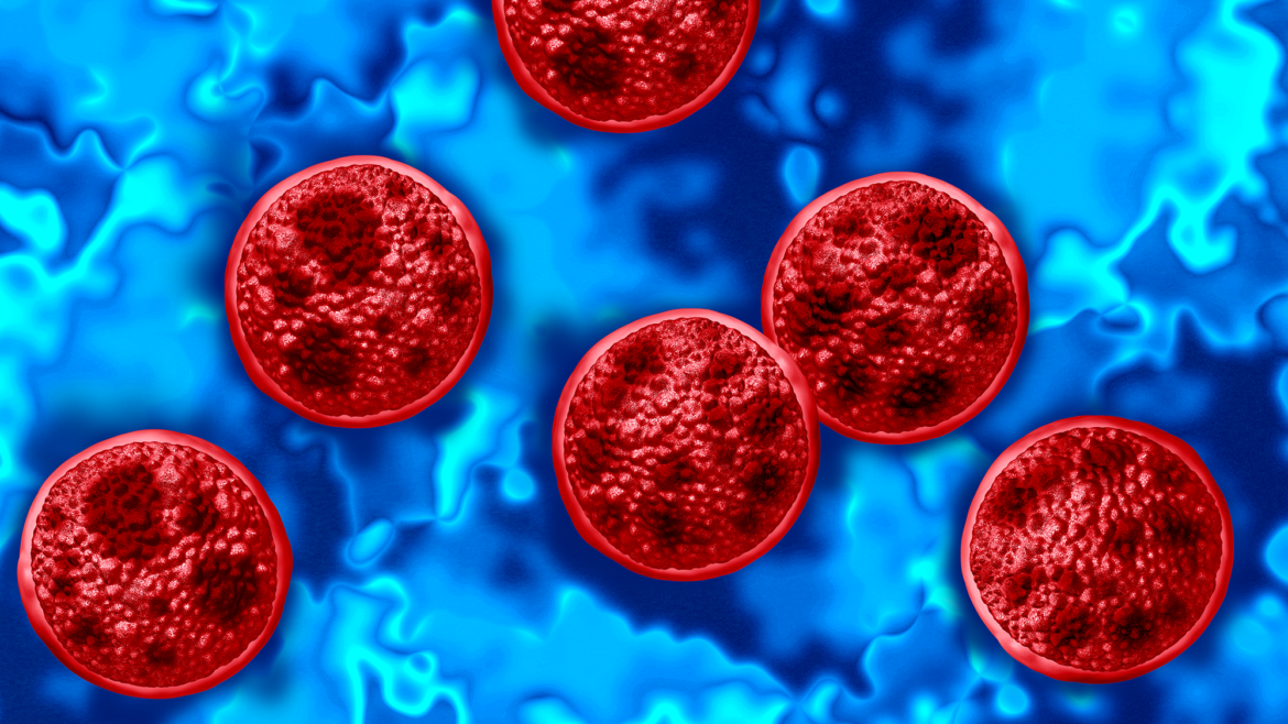 First deaths from Cyclospora outbreak reported in Michigan