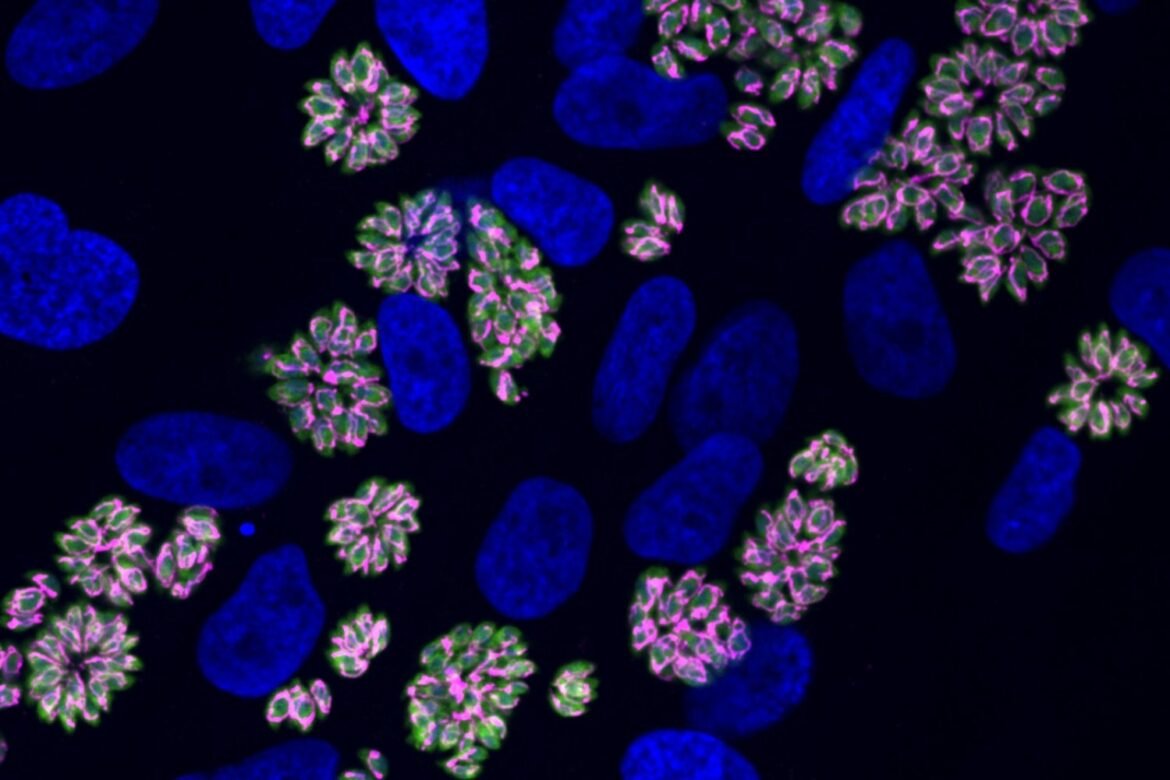 How the Toxoplasma parasite adapts to crowded conditions in host cells | MIT News