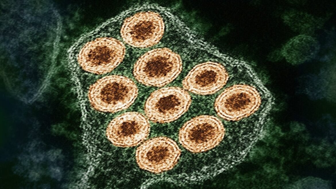 The US Only Diagnoses 7% of Its Human Rabies Cases, Study Finds : ScienceAlert
