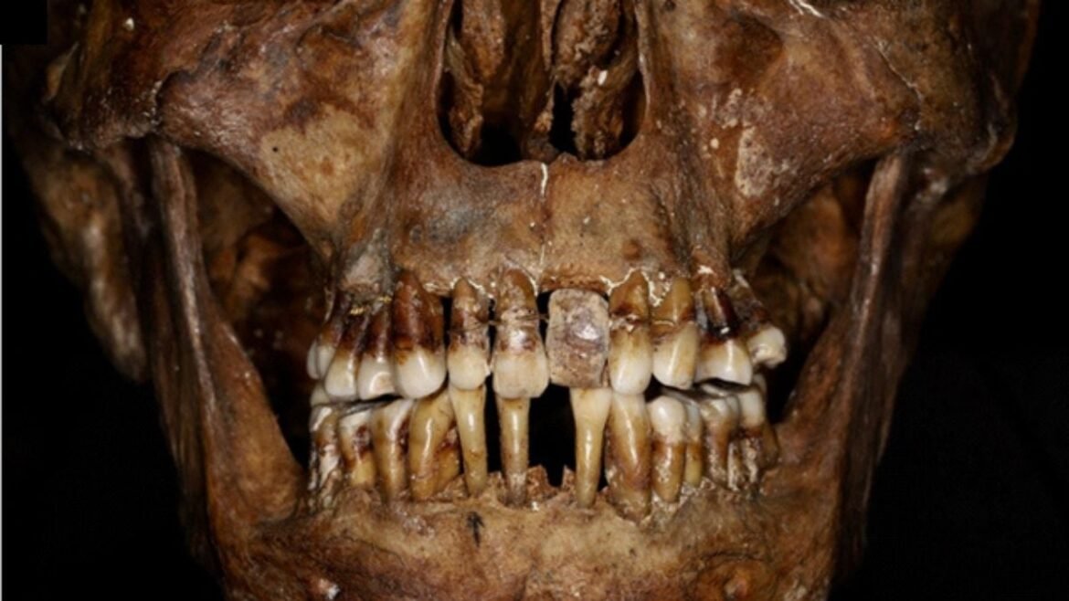 This 17th-Century Aristocrat Had an Ingenious Secret For Keeping Her Teeth : ScienceAlert