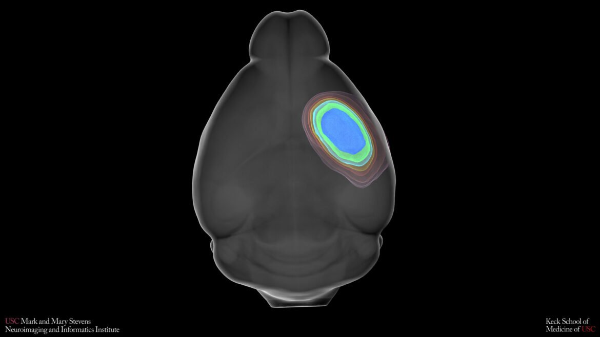 USC researchers develop automated MRI system to strengthen stroke treatment studies