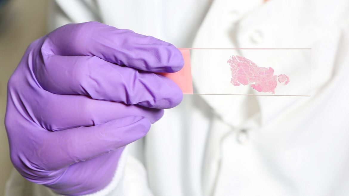 AI trained to 'think' like human pathologists may be better at spotting cancer