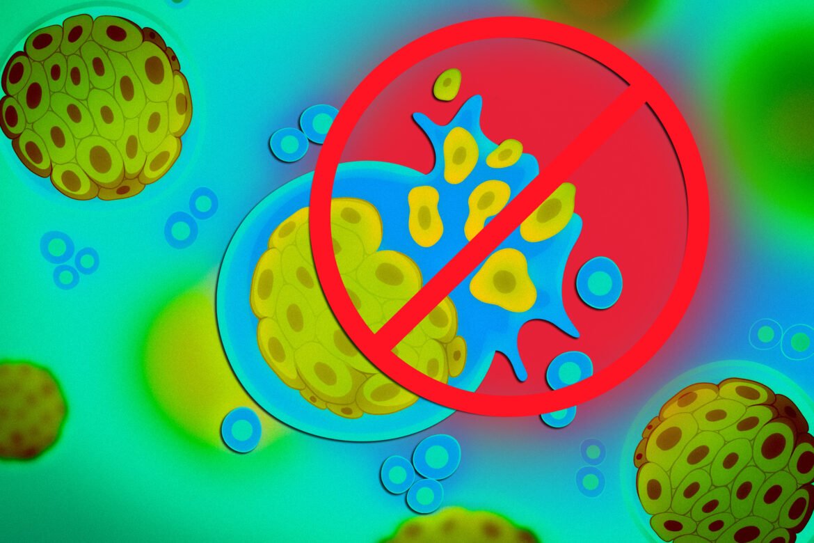 Biologists identify a cellular pathway that allows colorectal cancer to metastasize | MIT News