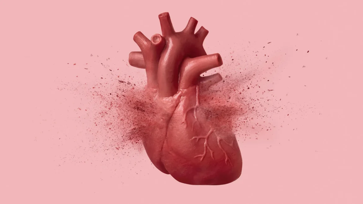 “Broken heart syndrome” can look just like a heart attack. This test can tell them apart