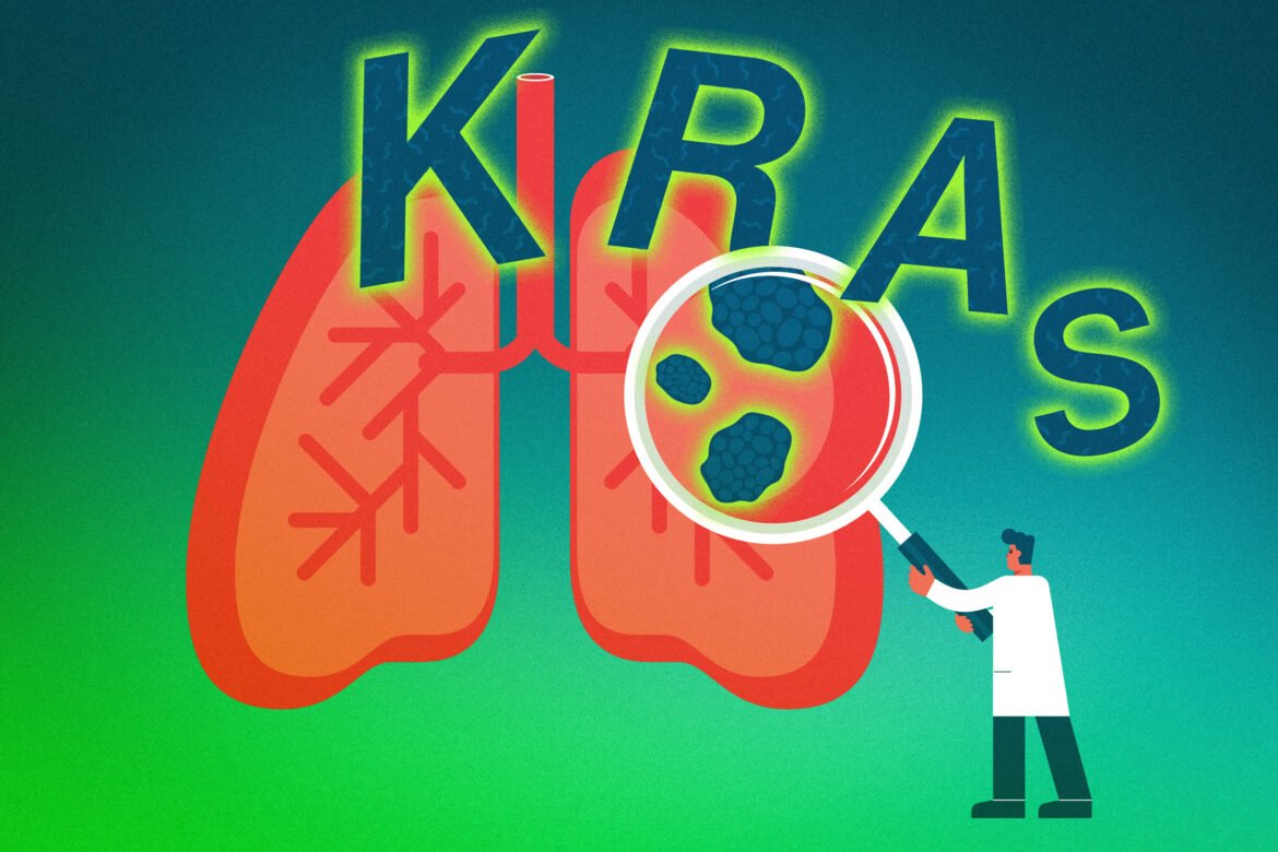 Lung cancers can use two different mechanisms to evade KRAS-inhibiting drugs | MIT News