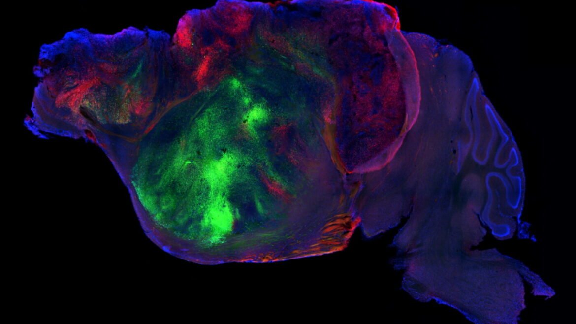 Mice with human brain cells offer a tool to study disease. Ethicists ask: What’s next? : NPR