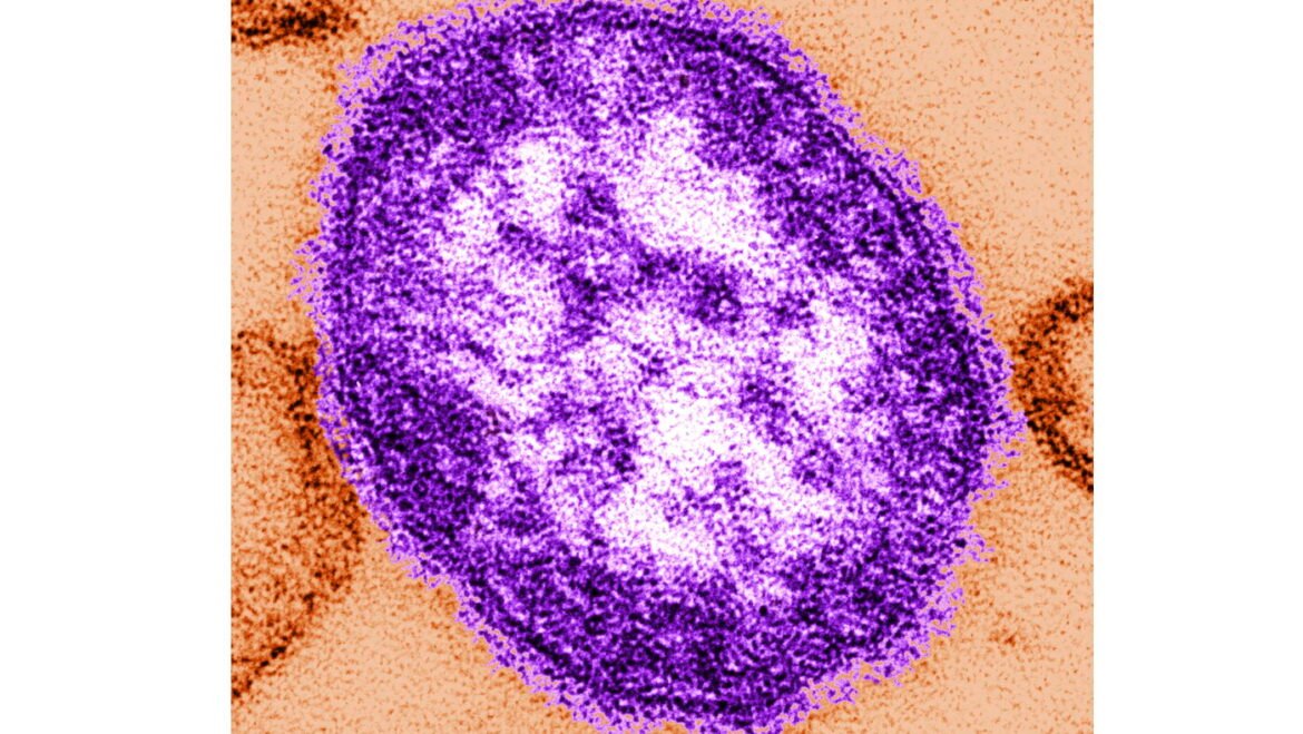 Pennsylvanian dies from measles-related complications amid state rift with feds : NPR