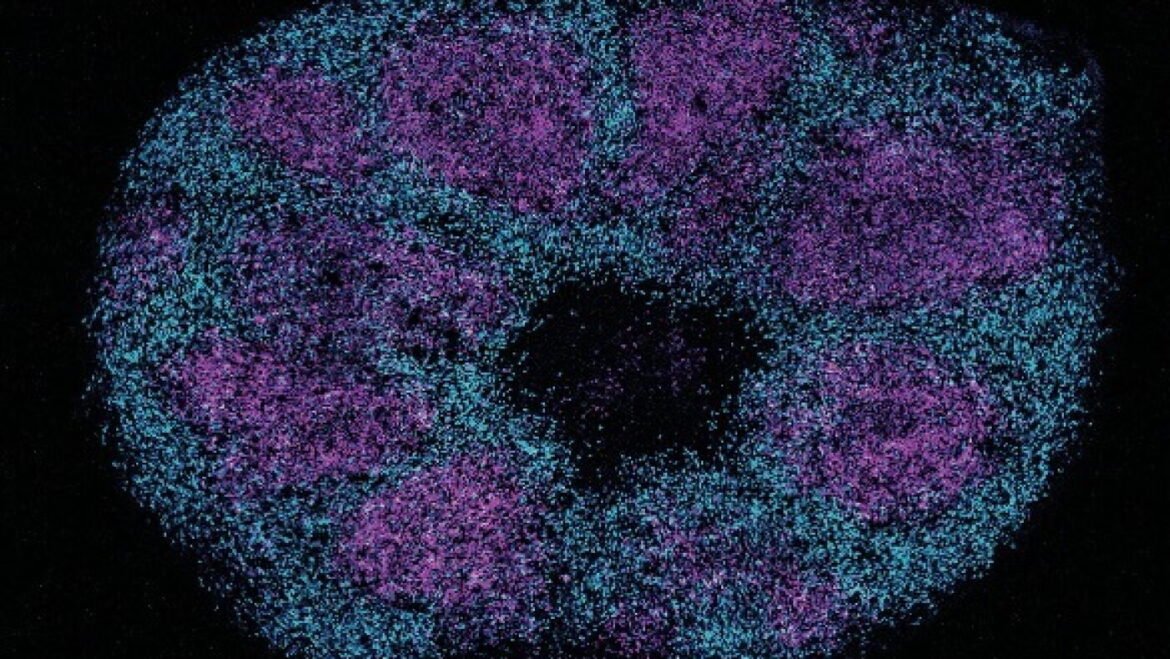 Scientists map key protein interactions linked with profound autism : NPR