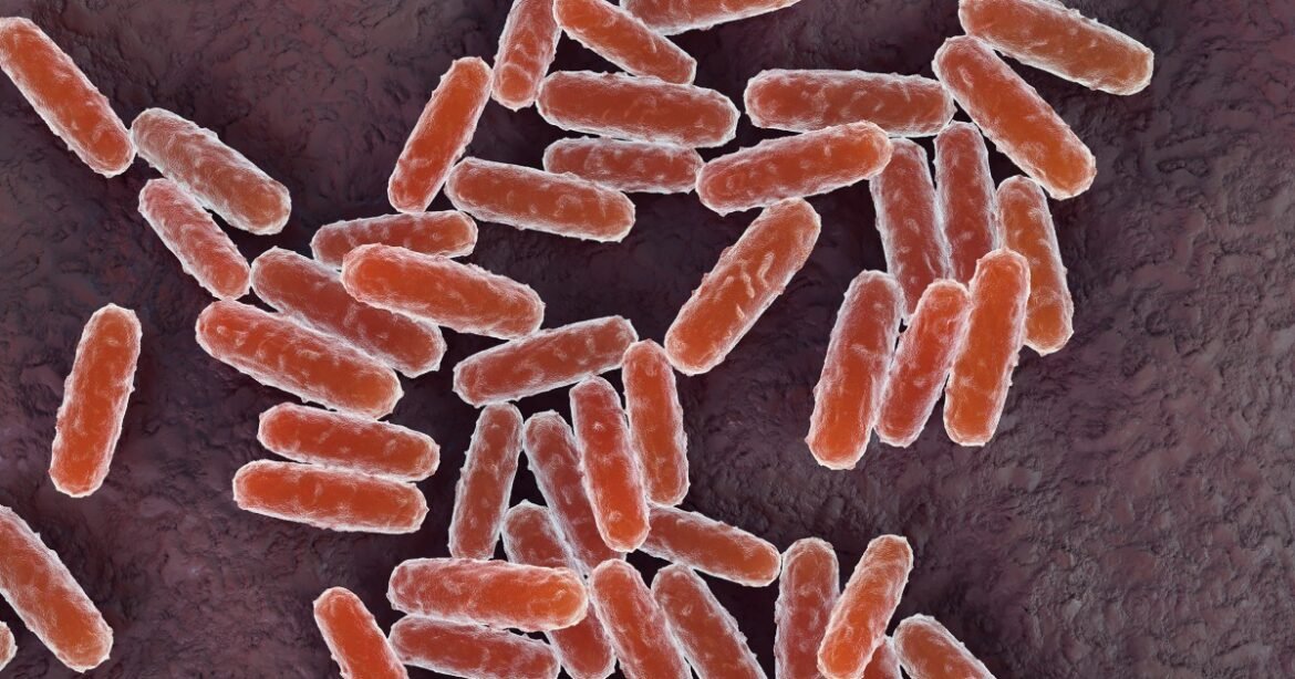 Russian lab worker dies of suspected plague as 200 enter medical observation