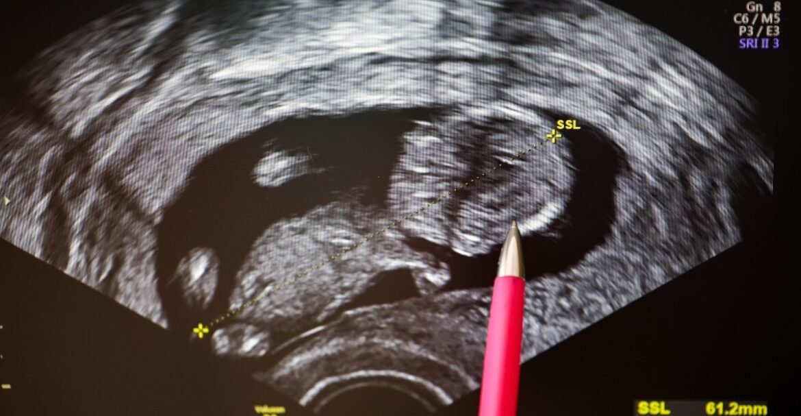 Should you get genetic screening before you have a child?